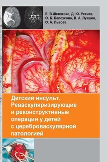Детский инсульт. Реваскуляризирующие и реконструктивные операции у детей с цереброваскулярной патологией